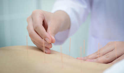 Intramuscular Stimulation  Calgary Acupuncture Clinic